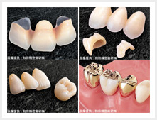 �I�[���Z���~�b�N�i�N���E���E�C�����[�j